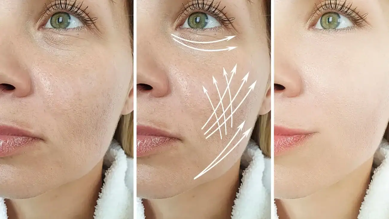 Can One Treatment Really Tackle More Than One Skin Concern Stourbridge?