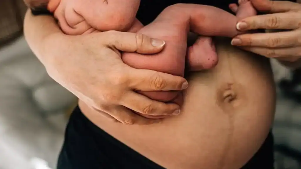 Why Is My Stomach Still Big After Pregnancy Stourbridge?
